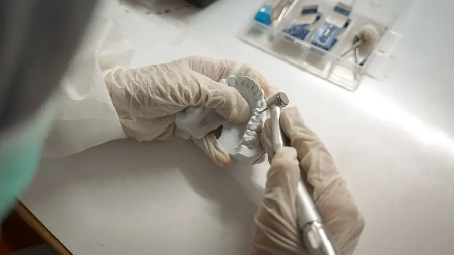 Treviso, mandibola ricostruita in 3D su una paziente di 17 anni