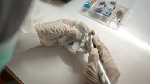 Treviso, mandibola ricostruita in 3D su una paziente di 17 anni